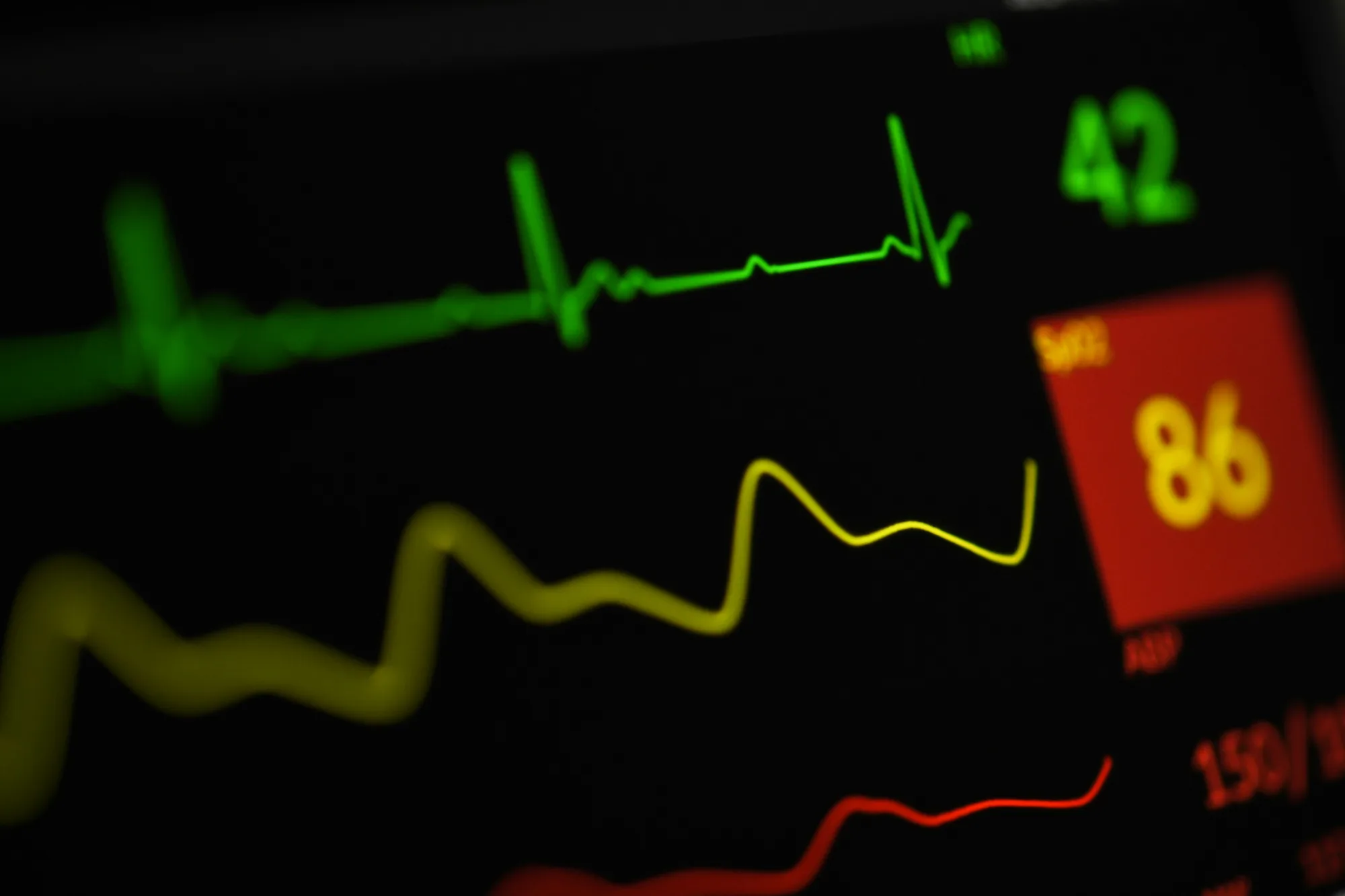 Patient monitor showing heart rate and vital-sign waves